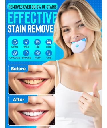 Nicwell Teeth Whitening Kit for Sensitive Tooth: 3 x 35% Carbamide Peroxide Gel & 1 Safe Remineralizing Pen - Teeth whitening LED light for Glow Gen Aged 18-34 - Oral Care for Dentist Office Daily use - Buy Online on GoSupps.com