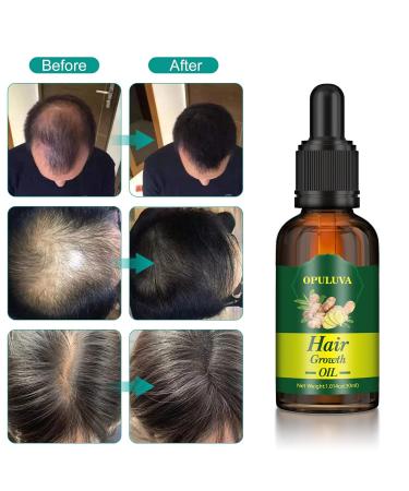 Ginger Hair Growth Serum - Stronger, Thicker, Longer Hair - Thinning Treatment - 3 Pack 30ML - Buy Online on GoSupps.com