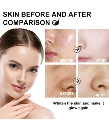 Snail Anti Aging Face Cream - Snail Face Cream for Women - Anti Wrinkle Face Moisturiser Spf 45 UV Protection- Dark Spot Remover Brightening Face Cream - Moisturiser Face 30ml - Buy Online on GoSupps.com