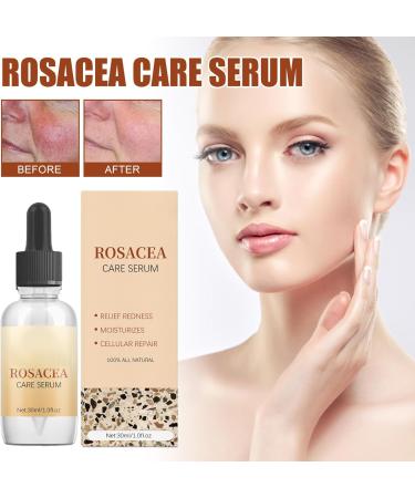 Rosacea Face Serum Face Serum Hyaluronic Acid Face Oil Anti-Aging Relieve Redness &Quick Repair Damage Skin Niacinamide Serum Replumps & Hydrates Collagen Face Serum-Protect Skin+Reduce Acne-Women 1 - Buy Online on GoSupps.com