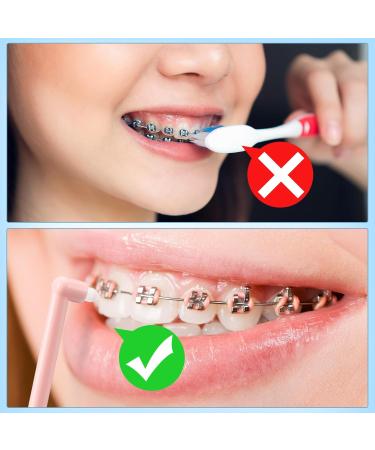 Wonyoing Soft Toothbrush Precise Cleaning for Wisdom Teeth & Implants | Small Head 48 Pack (Yellow Blue Pink Orange) - Ideal for Hard-to-Reach Areas - Buy Online on GoSupps.com