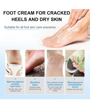 IZBEAUVO Retinol Foot Cream For Dry Cracked Feet Athletes Foot Cream Anti Fungal Skin Cream Cracked Heel Repair Cream Foot Moisturizer For Healthy Feet Callus Remover And Soften Relief For Dry Feet - Buy Online on GoSupps.com