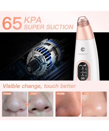 Blackhead Remover Vacuum - USB Pore Cleaner Tool for Men and Women | 3 Modes & 6 Suction Heads - Pink - Buy Online on GoSupps.com