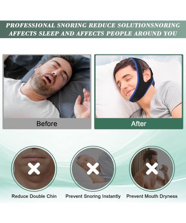 Adjustable Anti-Snoring Chin Strap for Sleep Apnea | Breathable Cpap Chin Strap | Effective Snoring Solution for Men and Women - Blue - Buy Online on GoSupps.com