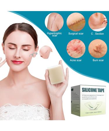 Henda Silicone Scar Sheets 1.6x120 Tape Roll - Professional Removal for C-Section, Burn, Acne, Keloid - Reusable & Softens Scars - Buy Online on GoSupps.com