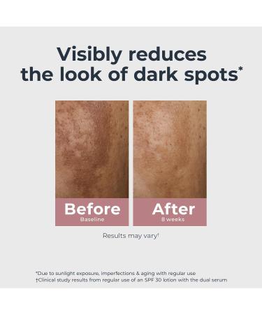 Eucerin Radiant Tone Dual Serum Dark Spot Corrector Dark Spot Serum with Thiamidol and Hyaluronic Acid Helps Visibly Reduce the Look of Persistent Dark Spots 1 Fl Oz Bottle - Buy Online on GoSupps.com