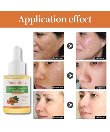 Turmeric & Vitamin C Dark Spot Corrector Serum | Anti-Aging & Moisturizing Formula for All Skin Types - 1oz - Buy Online on GoSupps.com