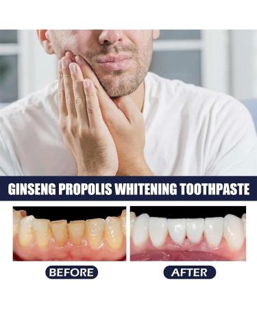 Ultimate Ginseng Propolis Tooth Whitening Toothpaste 2PCs | Best International Shipping - Buy Online on GoSupps.com