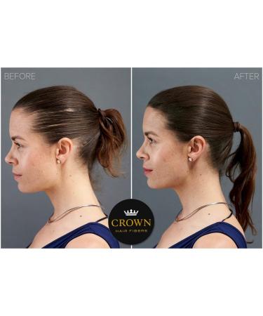CROWN Hair Fibers for Thinning Hair - Medium Brown 0.87oz/25g Bottle - Natural Keratin Hair Loss Concealer for Men & Women - Buy Online on GoSupps.com
