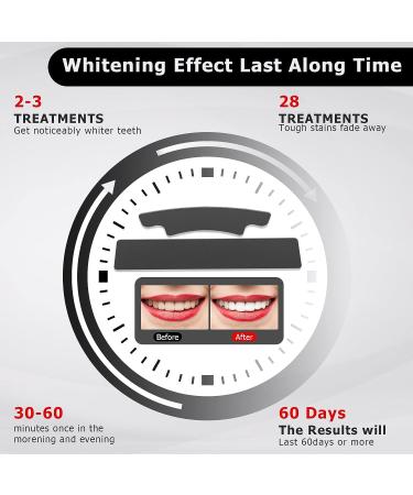 Professional Non-Sensitive Teeth Whitening Kit - Hot Pepper Coconut Strips | 56 Strips, 28 Treatments | Remove Coffee & Tea Stains - Buy Online on GoSupps.com