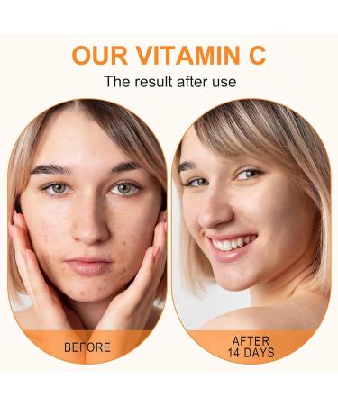 Vitamin C Serum For Face Vitamin C Serum With Hyaluronic Acid And Glycerol Boost Skin Collagen Anti Aging Serum Anti Wrinkle Facial Serum Anti-Aging Wrinkles Dark Spots Facial Skin Care - Buy Online on GoSupps.com