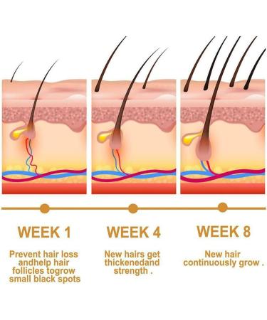 Xltyyds Puraect Fermented Rice Water Serum - Biotin Hair Growth Enhancer for Thinning Hair & Hair Loss (10ml 2PCs) - International Shipping Available - Buy Online on GoSupps.com