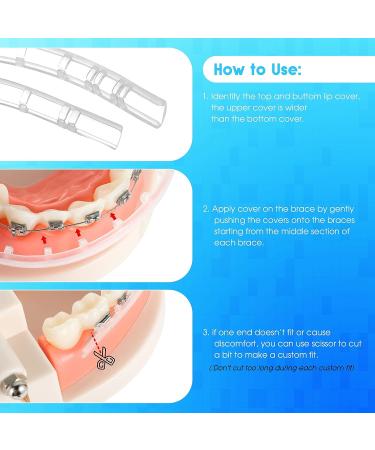 Obrush Clip-on Comfort Covers for Braces - Orthodontic Lip Protector & Wax Cover | Braces Accessories - Buy Online on GoSupps.com