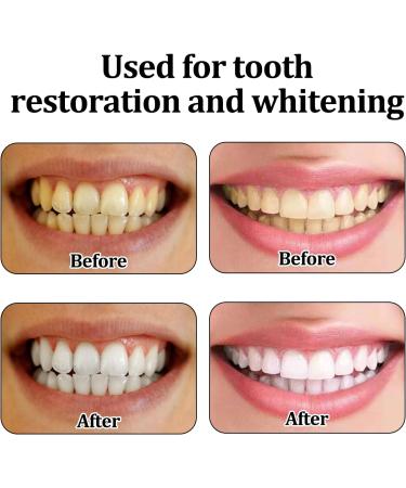 4 PCs Adjustable Dentures for Plug-in False Teeth | Full Dental Prosthesis & Snap Lock Veneers - Buy Online on GoSupps.com