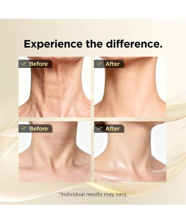 abarno Professional Neck Firming Cream Advanced Anti-Aging Formula for Neck and Decollete Area Moisturizing Treatment with Hyaluronic Acid-02 - Buy Online on GoSupps.com