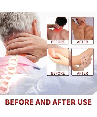 Buy Todahof Bienengift Psoriasis Treatment Cream - 3 PCs - Effective Bee Gift Cream for Psoriasis Relief | International Shipping Available - Buy Online on GoSupps.com