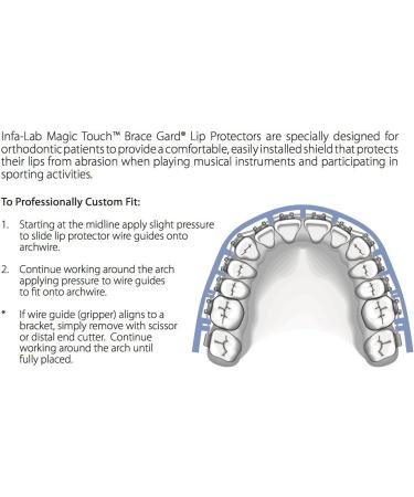 Orthodontic Braces Lip Guard Protector Shield (1 Set - Upper/Lower Teeth) with Instructions | AdentalZ - Buy Online on GoSupps.com