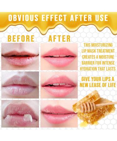 Bee Balm Lip Balm Honey Pot - Hydrating Moisturizing Lip Mask for Dry and Cracked Lips - Buy Online on GoSupps.com