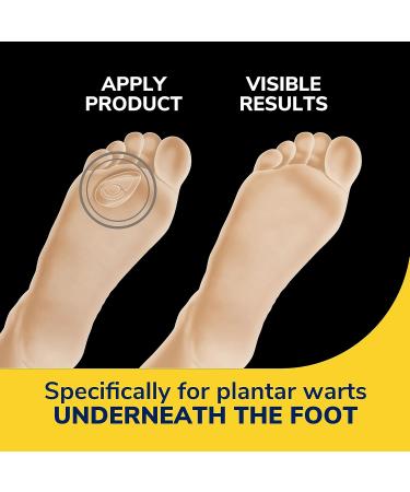 Dr. Scholl's Plantar WART Remover Hydrogel Bandage - 12 Discs & 10 Cushions for Immediate Pain Relief | Ultra-Thin Maximum Strength Formula - Buy Online on GoSupps.com