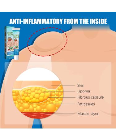 Buffet Lump-Free Lipoma Removal Ointment - Natural Vegetable Formula for Skin Anti-Swelling - One Size White - Buy Online on GoSupps.com