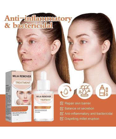 2024 New 1/2/3/4Pcs Milia Clearing Essence - Milia emover Eye Serum | Milia emover Milia Spot reatment | Miliary epair Essence | Moisturize Skin | Improve Skin Texture for All Skin Types - 30ml/1fl.oz (1pcs Milia Remover Serum) - Buy Online on GoSupps.com