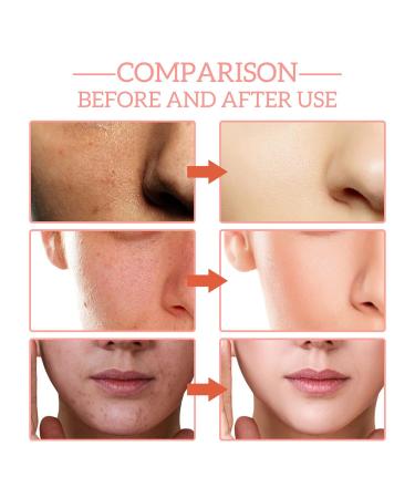 30% Vitamin C Face Serum | Niacinamide & Hyaluronic Acid | Anti-Aging Hydrating Serum for Women - Buy Online on GoSupps.com