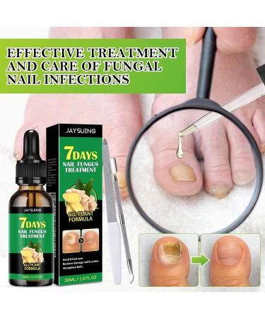 KERANEET Ginger Nail Care Nail Care Nail Repair Ginger Cuticle Care Oil for fragile nails protection to strengthen the nail treatment nail care ginger - Buy Online on GoSupps.com