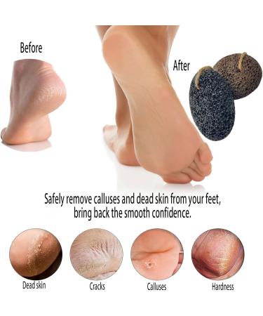 Natural Pumice Stone for Feet - Lava Foot Exfoliator Scrubber Pedicure Tools Callus Remover for Heavy Callused Feet Dead Skinand Hands - for Pedicure Cracked Heels (Brown*1) - Buy Online on GoSupps.com