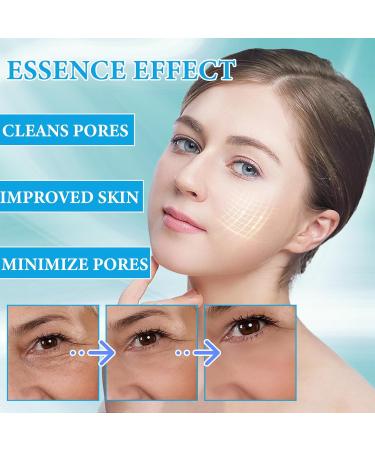Buy Botox Facial Serum - Anti-Aging Vitamin C & Collagen Solution for Women | Reduce Fine Lines & Wrinkles | Nourish & Plump Skin - Buy Online on GoSupps.com
