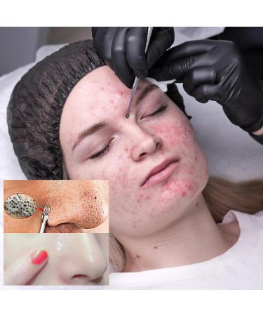 Whitehead Extractor Tool | Comedones Extractor Removal Kit - Stainless Multipurpose Whitehead Extractor Tool With Portable Case For Facial Nose - Buy Online on GoSupps.com