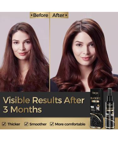 Hair Growth Serum - Organic Black Rice Water Spray for Thicker Fuller Hair - 3.38 Ounces - Boost Hair Regrowth & Combat Hair Loss - Buy Online on GoSupps.com