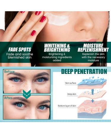  Orgrul 2025 New Japanese Melasma Cream Japanese Melasma Cream White Spot Cream Japanese Cream White Spot Cream Dark Spot Corrector for Face Skin Care Facial Moisturizer Cream (2PC) - Buy Online on GoSupps.com