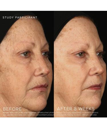 Rodan + Fields Reverse Brightening Toner - Hydrate Lighten & Even Skin Tone | Fades Dark Spots with Niacinamide & Licorice Extract - International Shipping Available - Buy Online on GoSupps.com