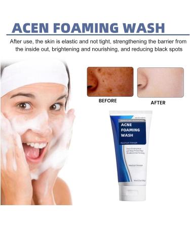 Acne Foam Wash Acne Foaming Wash Mild Daily Facial Cleanser for Deep Pore Cleansing Face Wash Women Mild Cleansing Cleansing Foam Exfoliating Face Wash Foaming Cleanser Facial Wash Cleansing Foam - Buy Online on GoSupps.com
