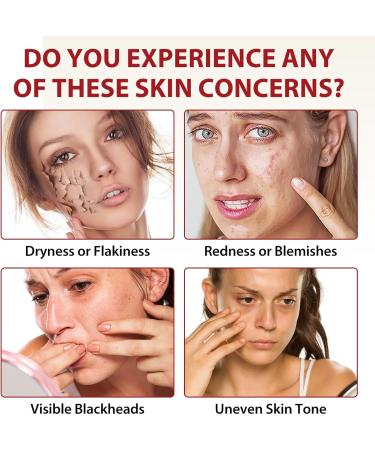 ikzee 2 pieces Peel Shot Glow Rice Ampoule Duo with niacinamide and arbutin Pure Skin Peel Shot gentle peeling rice peeling face depth effective hydration rice peel glow serum 100 ml 2PACK rice exfoliant - Buy Online on GoSupps.com