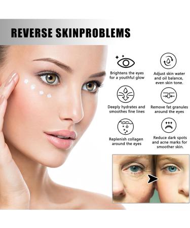 Eye Cream for Dark Circles Anti Wrinkle Eye Cream Anti-Aging Eye Care Products for All Skin Types Eye Repair Cream for Dark Circles Dark Circle Eye Skin Care Firming Eye Cream 2pc - Buy Online on GoSupps.com