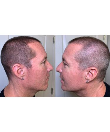 Thicken It Black Scalp Coverage Hair Powder - Talc-Free .32 oz, Water Resistant Hair Loss Concealer for Men and Women - Natural Thicker Hair Solution - Buy Online on GoSupps.com