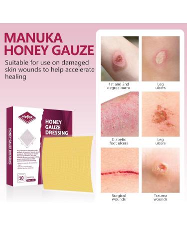 Manuka Honey Gauze Dressing 2x2 | Medical Grade Honey Patches for Wound Care | Pack of 10 for Faster Healing - Buy Online on GoSupps.com