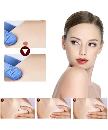 Anti Wart - Anti Wart Pen - Pen To Remove Mole - Anti Skin Tag Pen - Pen To Remove Skin Tags Remove Skin Tags - Buy Online on GoSupps.com
