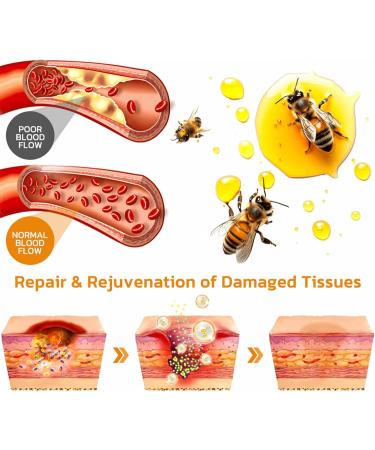 ZVLZVL Bee Venom Treatment Cream - Moisturizer & Skin Repair for Men & Women (30ml) | Buy Internationally - Buy Online on GoSupps.com