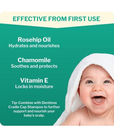Dentinox Baby Scalp Oil with Chamomile, Rosehip & Vitamin E - 30ml (Pack of 1) - Buy Online on GoSupps.com