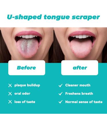 Stainless Steel Tongue Scraper & Cleaner - 2 Pack | Fresh Breath & Oral Hygiene | Metal Storage Case - Buy Online on GoSupps.com