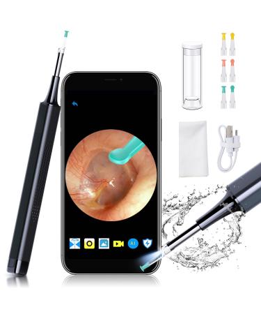 Ear Wax Removal Cleaning Kit - ASHINER Earwax Cleaner Tool with 1080P Camera and LED Lights  Ear Curette Scope Otoscope for Kids  Toddler  Baby  Wireless Ear Pick Endoscope Compatible with Smart Phone