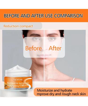 Turmeric Neck Firming Cream Neck Tightening Cream Face Firming Cream All Natural Turmeric Skin Brightening Lotion For Tightening & Lift Skin Fine lines Loose & Sagging Skin On Face Neck - Buy Online on GoSupps.com