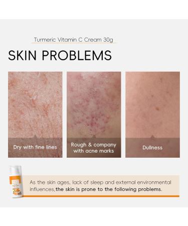 GNAUMORE Turmeric Vitamin Cream Turmeric Whitening and Brightening Cream Moisturizing Vitamin C Repair Gel for Men and Women Dark Spot Remover 30g - Buy Online on GoSupps.com