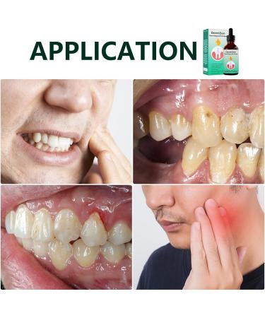 Eastuy Gum Care Products - 1.01 oz Natural Oral Drops for Gum Restoration | Premium Oral Care Fluid - Buy Online on GoSupps.com