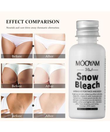 Zibeem Skin whitening cream for dark skin 30 ml cream for the correction of dark spots body cream for the intimate area skin whitening cream for the body and sensitive areas - Buy Online on GoSupps.com