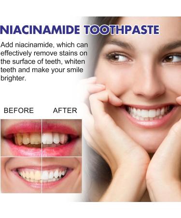 Niacinamide & Peppermint Toothpaste for Teeth Whitening Deep Cleansing Formula for Stain Removal and Plaque Control Strengthens Enamel Freshens Breath Gently 3.53 OZ - Buy Online on GoSupps.com