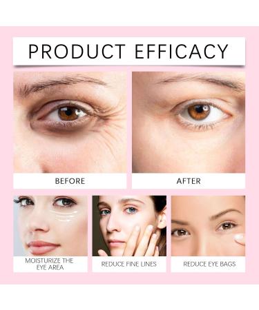  BAInuai Jasmine Ointment Plus collagen eye cream for dark circles collagen and aloe vera eye cream (2) - Buy Online on GoSupps.com