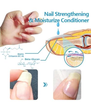2PCS OnycholysisHeal Nail Strengthening And Growth Conditioner Nail Strengthener for Damaged Nails - Buy Online on GoSupps.com